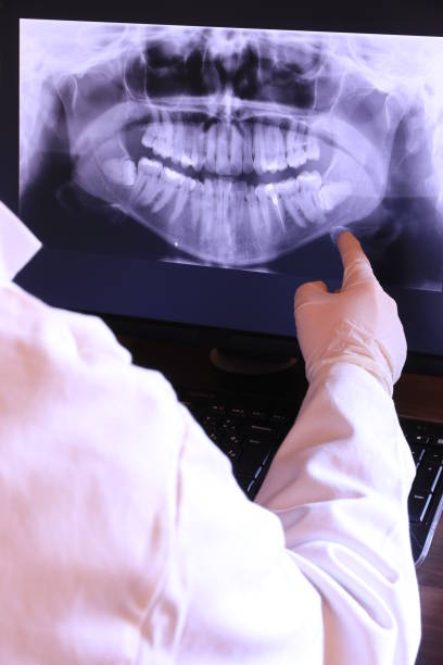 Best Emergency Dental Care for Broken or Chipped Teeth in Westland, MI